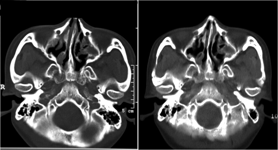 Cross-sectional CT image