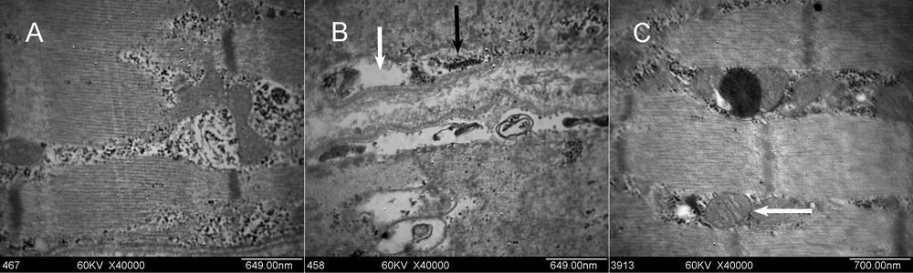 人咬肌内的线粒体结构