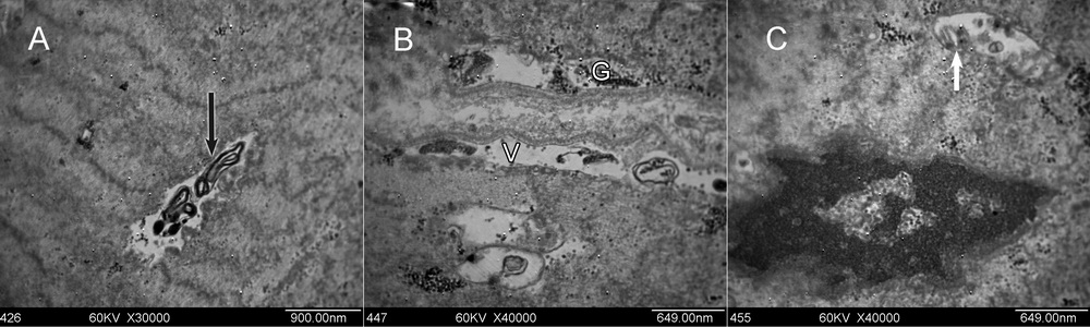 人咬肌线粒体变化