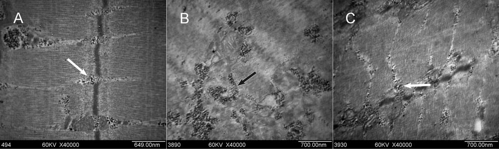 咬肌纤维内的三联体