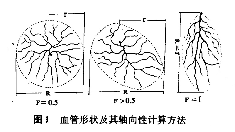 小腿皮动脉血管形状及其轴向性的计算方法