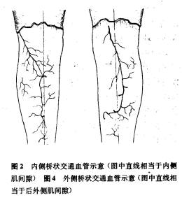 小腿桥状交通皮动脉血管