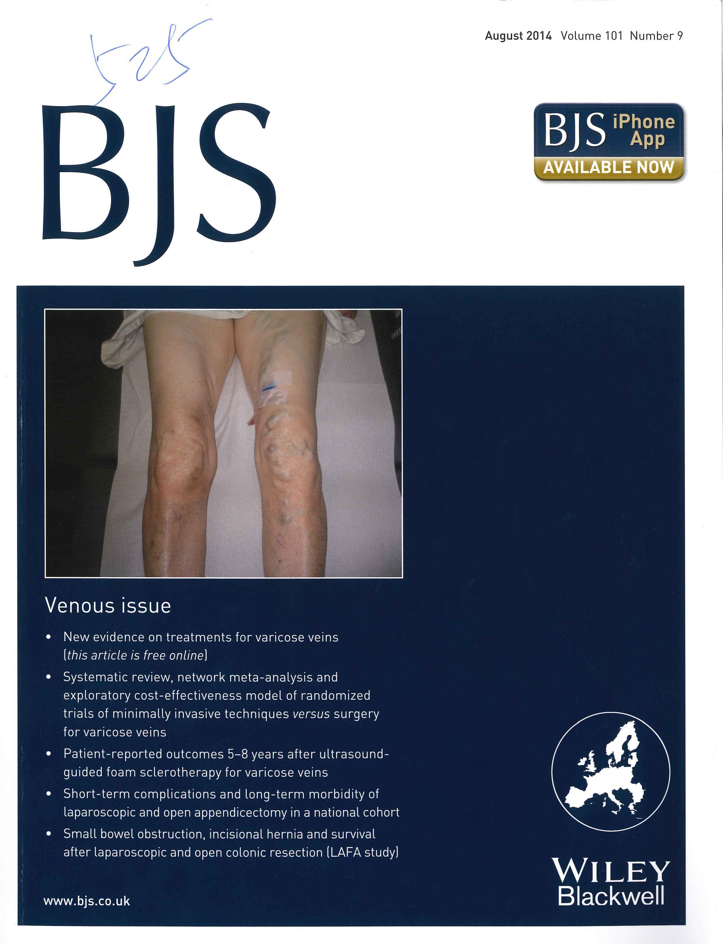 奥美定注射隆胸后注射物取出发表