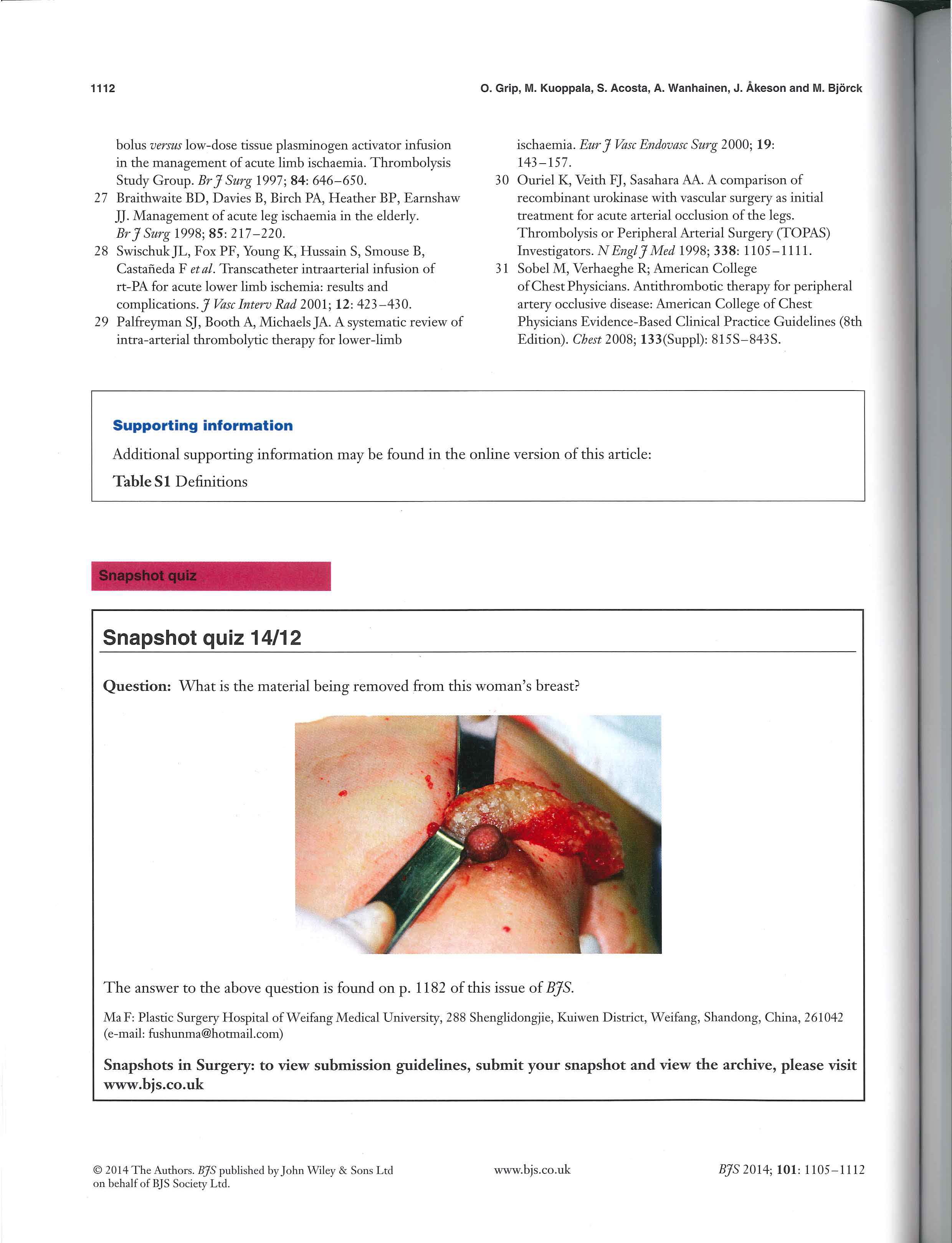 奥美定注射隆胸后注射物取出发表1