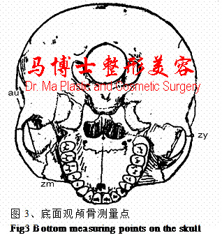 颌面骨底面骨性测量点