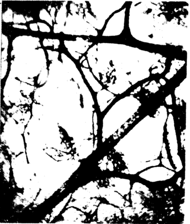 真皮下血管网深面的较粗大浅静脉干