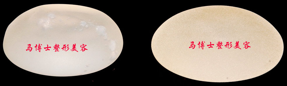 硅胶乳房假体正面观