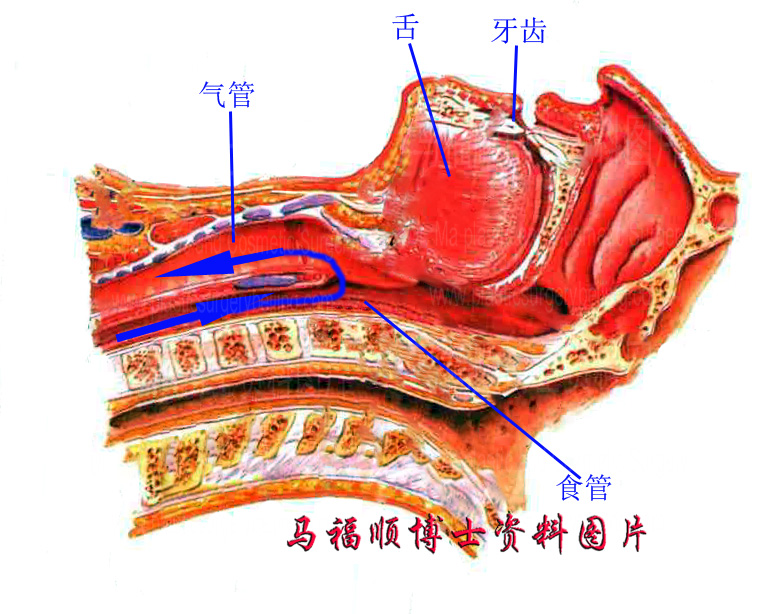 全身麻醉禁食水的重要性