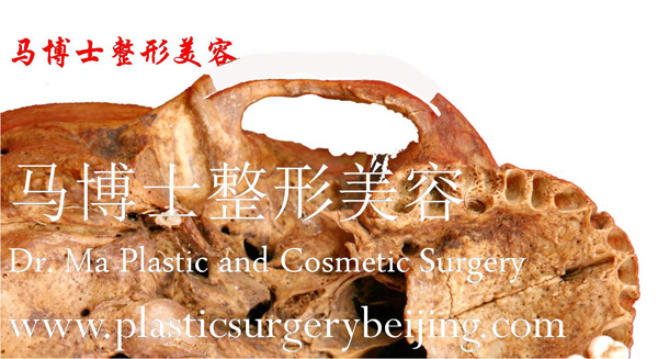 颧骨颧弓前后端截骨整形设计原理