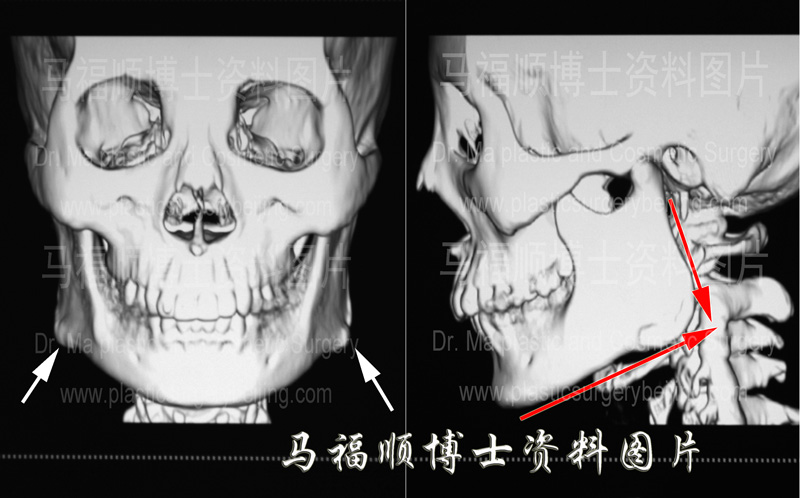 由字脸面部骨骼CT片