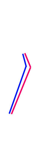 颧突点降低示意图