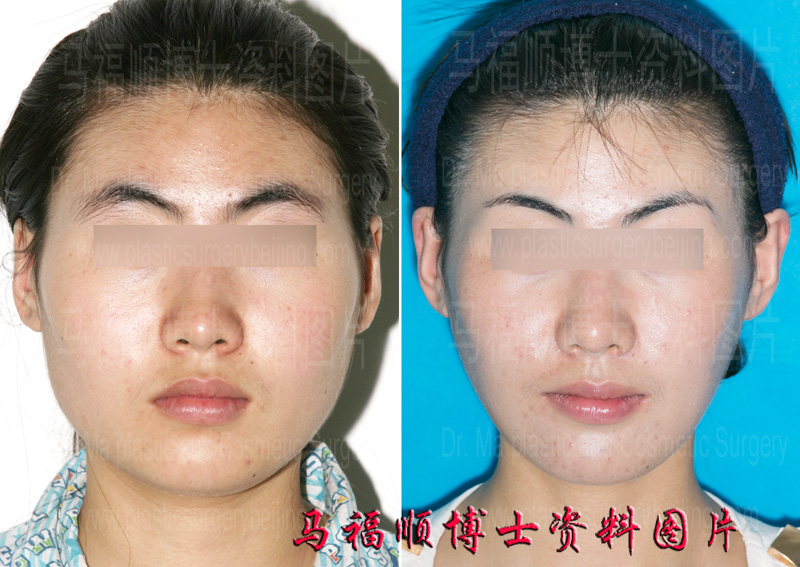 大脸变小脸