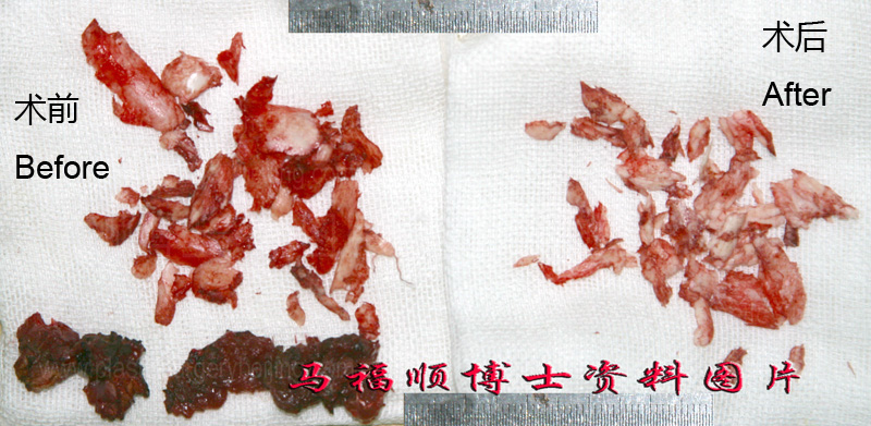 下巴与下颌整形