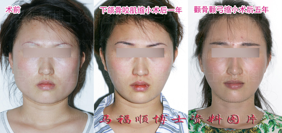 大脸变小脸